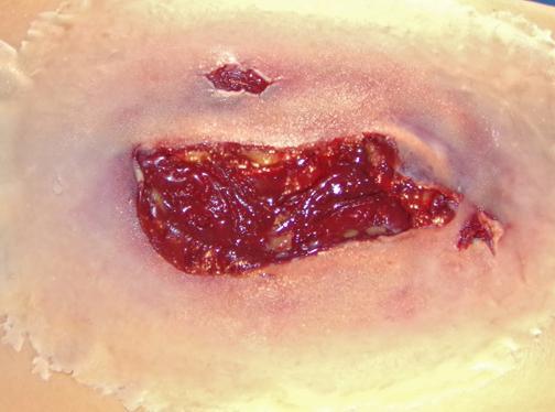 Self Adhesive Wounds Laceration Large Tactical Distributors Ltd New Zealand