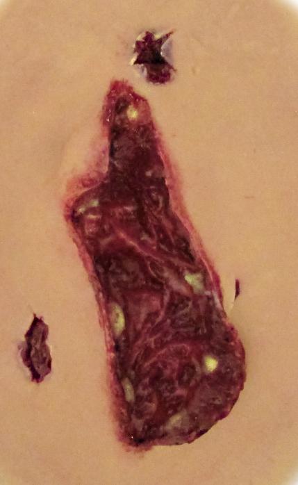 Self Adhesive Wounds Laceration Large Tactical Distributors Ltd New Zealand