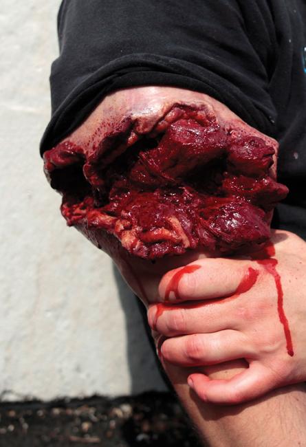 Wearable Wounds GSW Bicep Tactical Distributors Ltd New Zealand